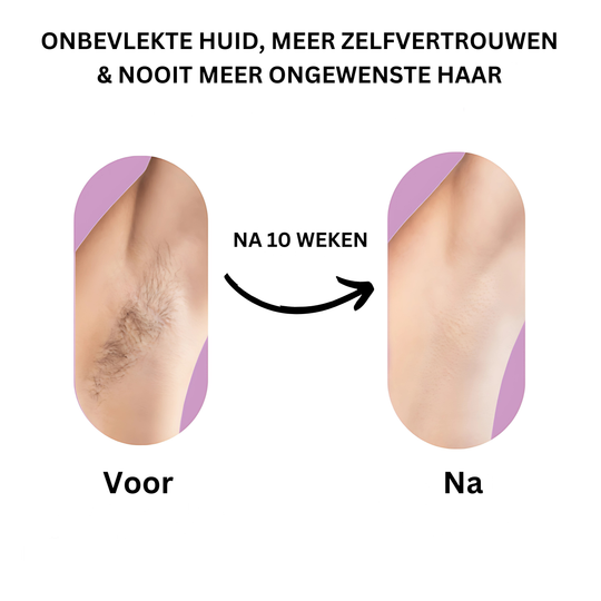 GladGloed™ Voor- Na